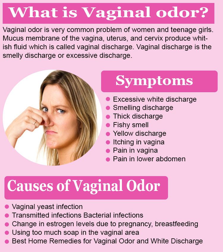 discharge vaginal odour