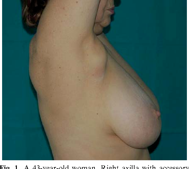 in tissue axilla breast