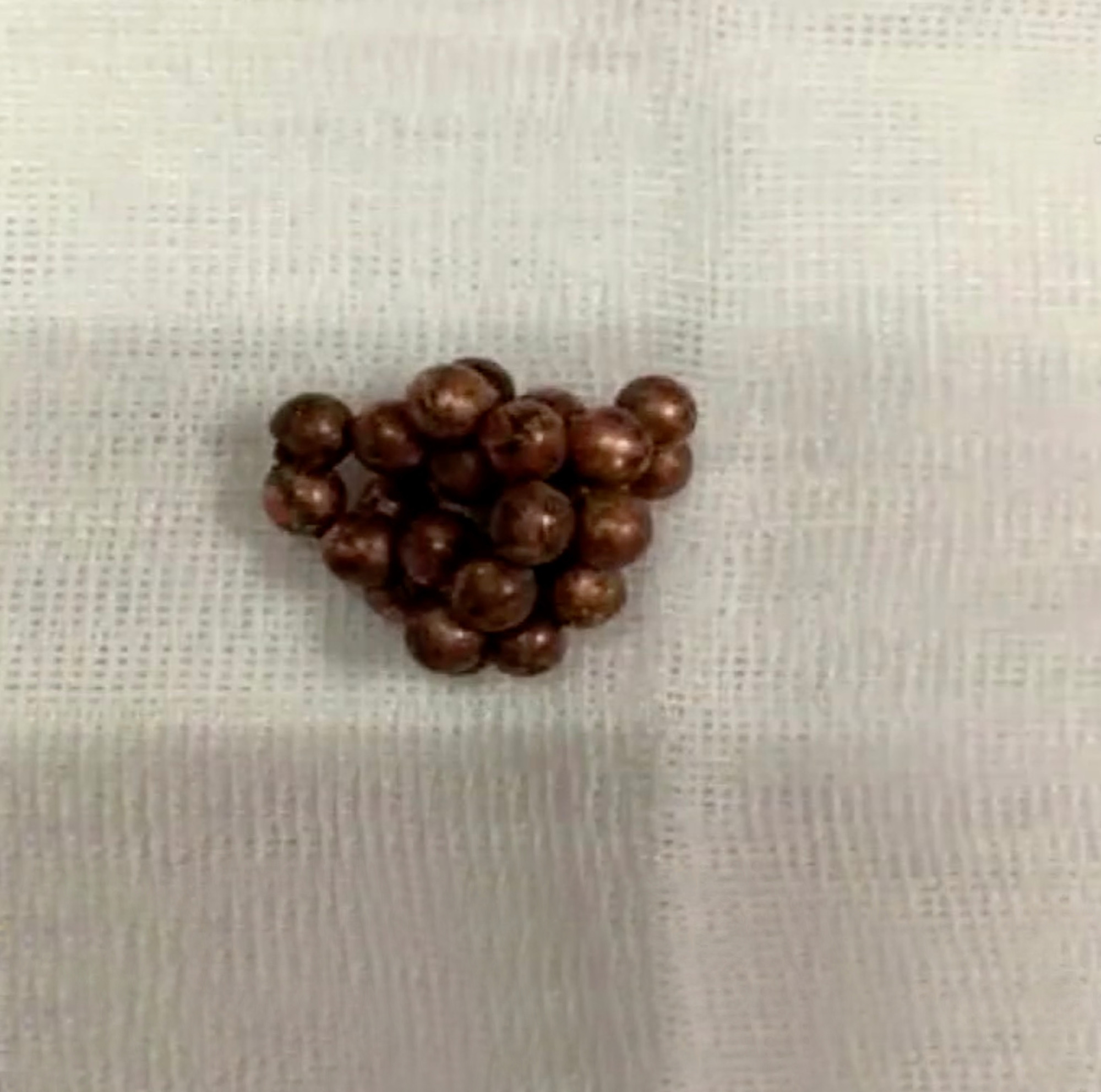 europe penis bead