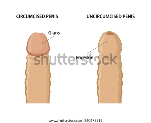 penis uncircumcised have i an
