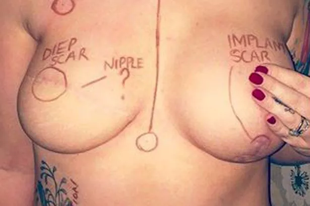 breast boobs with cancer